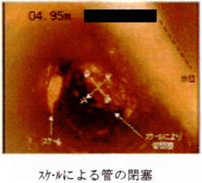 スケールによる管の閉塞