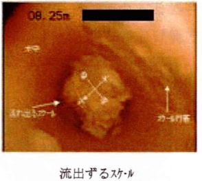 流出するスケール